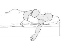 Ночью спать нужно здоровом боку, при это нужна подушка для поддержки больной руки