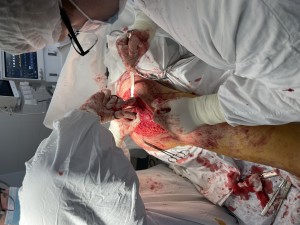 Вид операционной раны